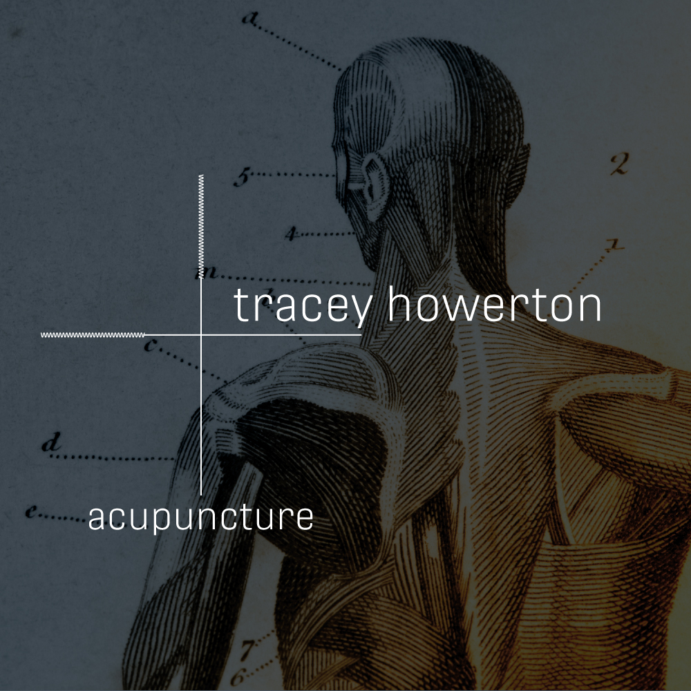 licensed acupuncture practitioner Tracey Howerton / Denver